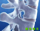 腰椎间盘突出如何治疗：可信赖的腰椎间盘突出专科在哪里