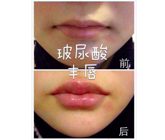 黄浦注射美容整形培训-上海知名的注射美容整形培训资讯