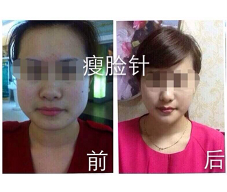 松江微整形，专业的整形美容培训妃美提供