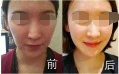 哪儿有提供整形培训-卢湾整形培训