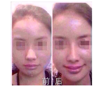 要找整形美容培训就找妃美-可信的微整形