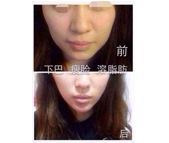 哪儿有提供整形培训-卢湾整形培训