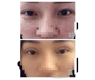 好口碑的整形美容培训资讯-上乘整形美容培训