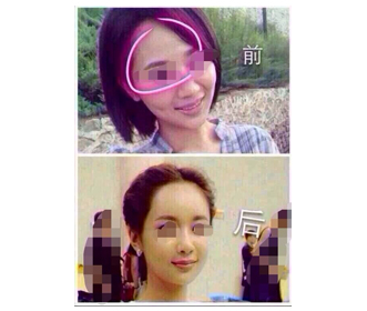 实惠的微整形，专业的整形美容培训哪里有