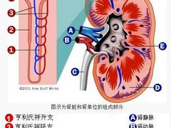 肾结石治疗优选曙光-厦门肾结石治疗