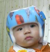 【供应】台北价位合理的婴儿头盔-宝宝矫正头盔
