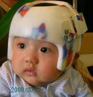 台北哪家婴儿头盔供应商好 婴儿矫正头盔哪家好