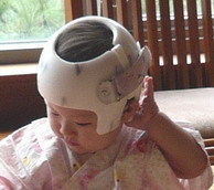 婴儿头盔