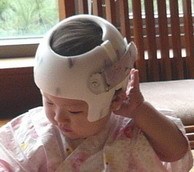 高性价嬰兒頭型美化頭盔【荐】_云南婴儿头型美化头盔