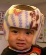 台灣歐恩比提供超便宜的嬰兒頭型美化頭盔|江西矫正婴儿头型