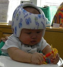 口碑好的婴儿头盔創健供应|婴儿头型矫正枕头