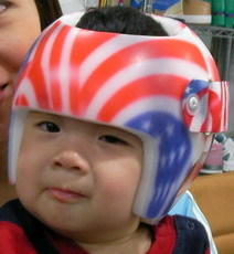 台北哪里有卖专业的婴儿头盔 婴儿头型矫正枕头