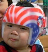 内蒙古矫正婴儿头型_哪里有销售优惠的嬰兒頭型美化頭盔